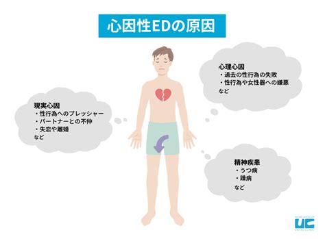 緊張で勃たない|EDのほとんどは「勃たなかったらどうしようか症候群」 [ED・。